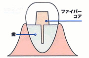 ファイバーコア